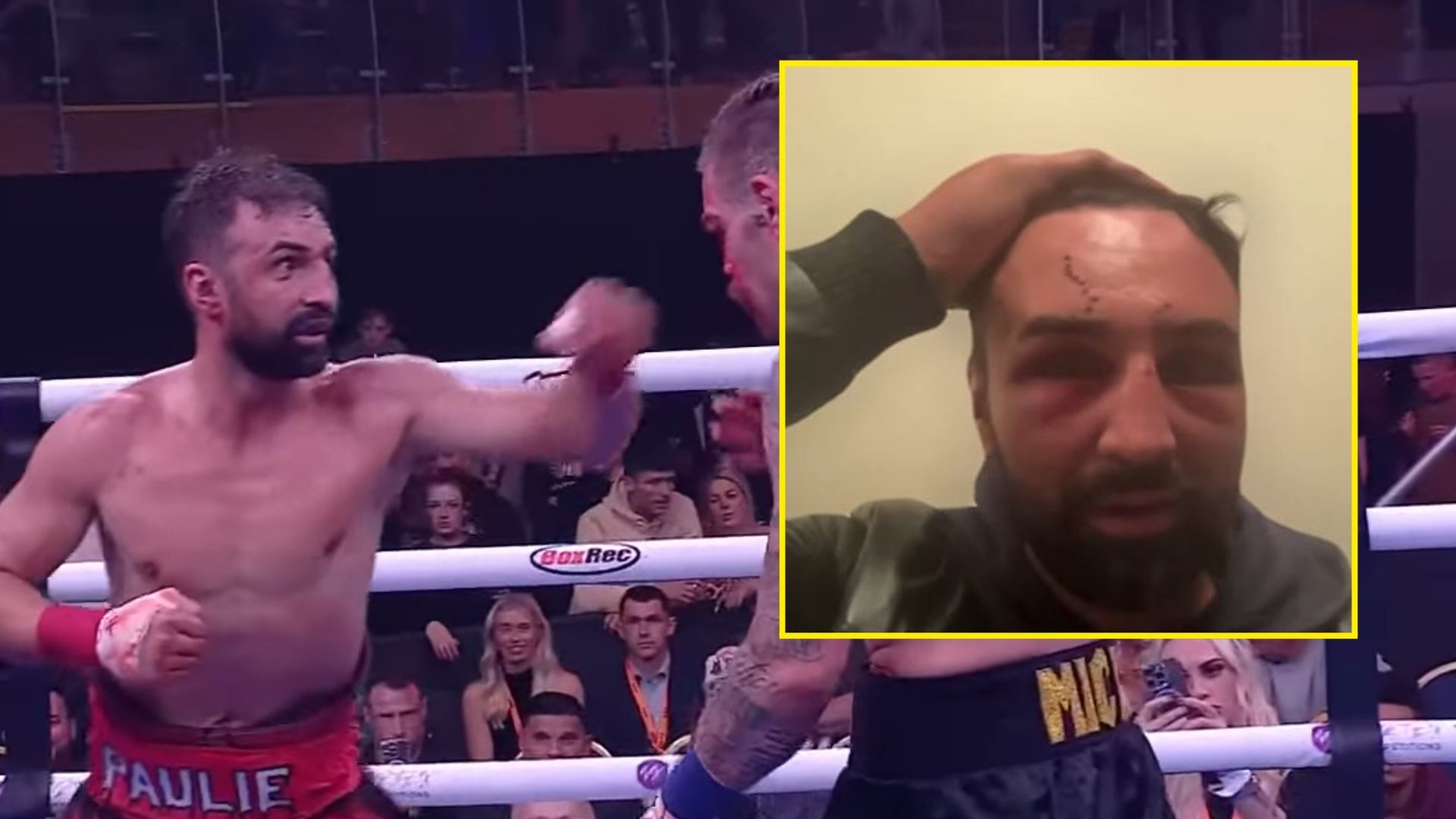 保利·馬里格納吉 (Paulie Malignaggi) 在因嚴重受傷而“失明”後，獲得了赤指關節拳擊世界冠軍頭銜