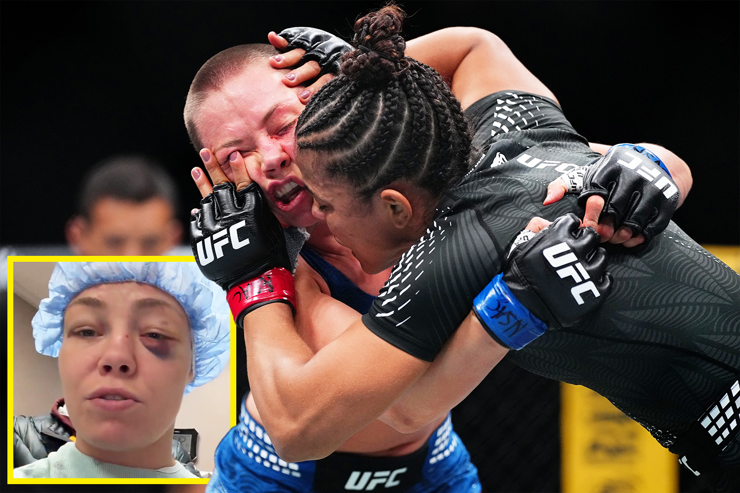 “我很沮喪”——UFC 明星羅絲·納瑪尤納斯在 UFC 324 比賽中被人刺傷眼部，正在接受眼科手術