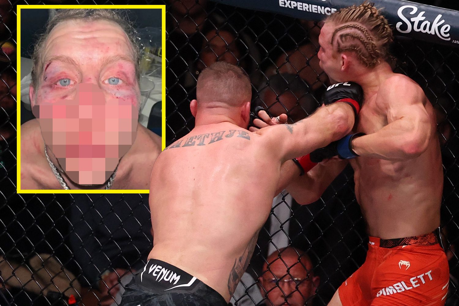 達納·懷特 (Dana White) 分享了 UFC 明星被送往醫院時帕迪·平布利特 (Paddy Pimblett) 被嚴重毆打的臉的照片
