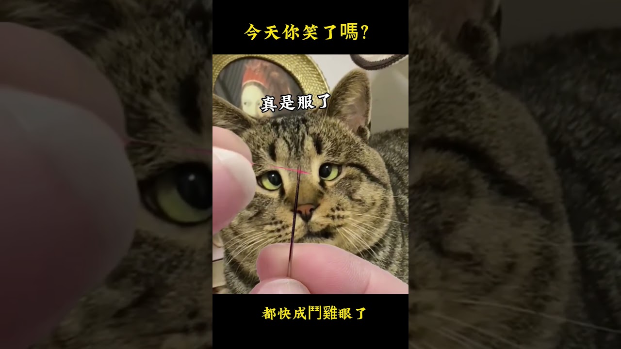 Lác mắt (鬥雞眼): Nguyên nhân, nhận biết và cách điều trị hiệu quả
