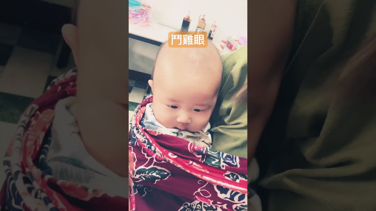 Thiên Vũ Mắt Lác: Khoảnh Khắc Bé Yêu Siêu Cute & Hài Hước