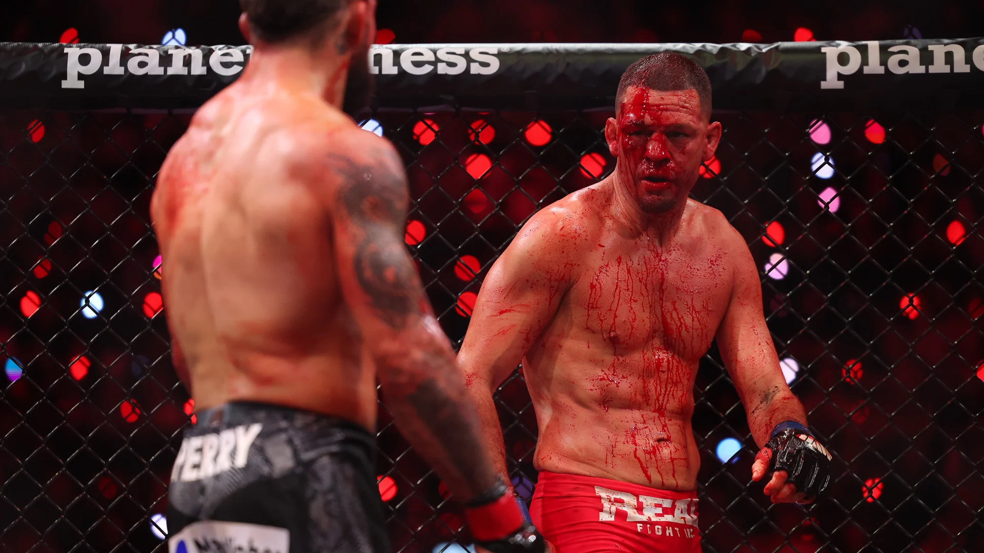 Nate Diaz needed 15 staples, 20 stitches after Mike Perry’s hellbow attack at MVP MMA 1